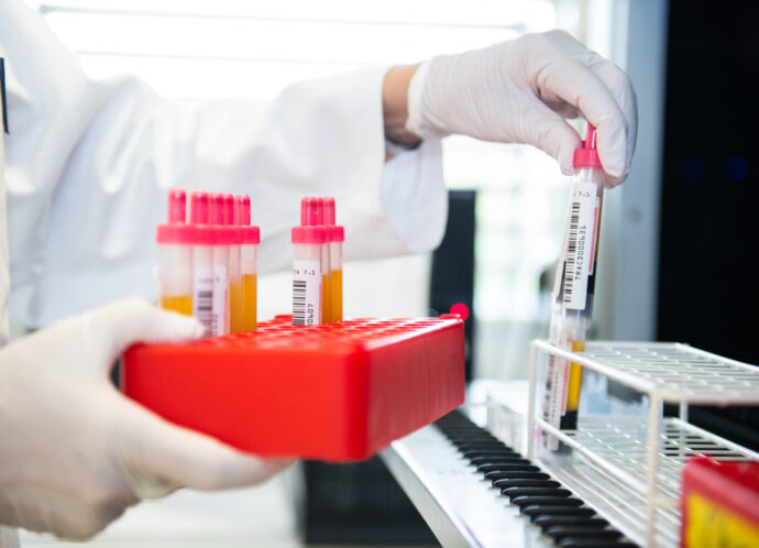 Biobank(c)medJUNGE-10